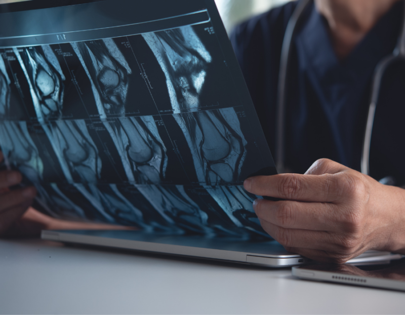 VA Orthopaedics Specialists in Hip and Knee Surgery